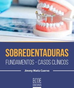 Sobredentaduras
